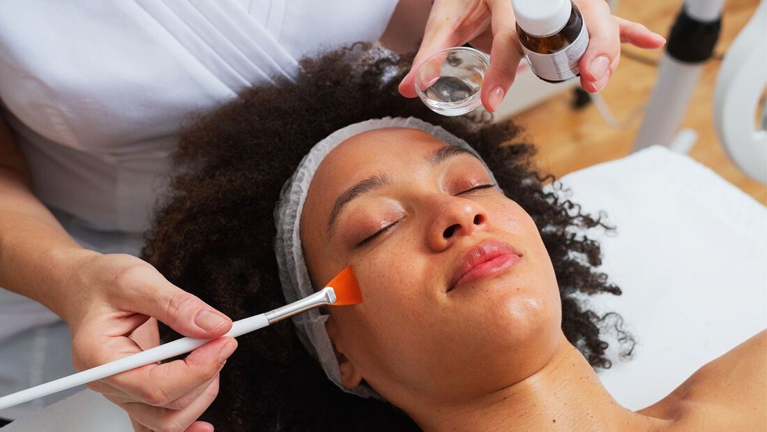  Chemical Peel vs. Microdermabrasion: Which is Right for You